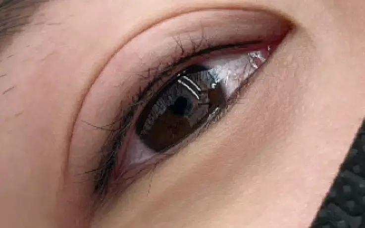 Procedure example of Eyeliner Tattoo