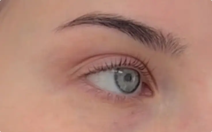 Procedure example of Lash Lift