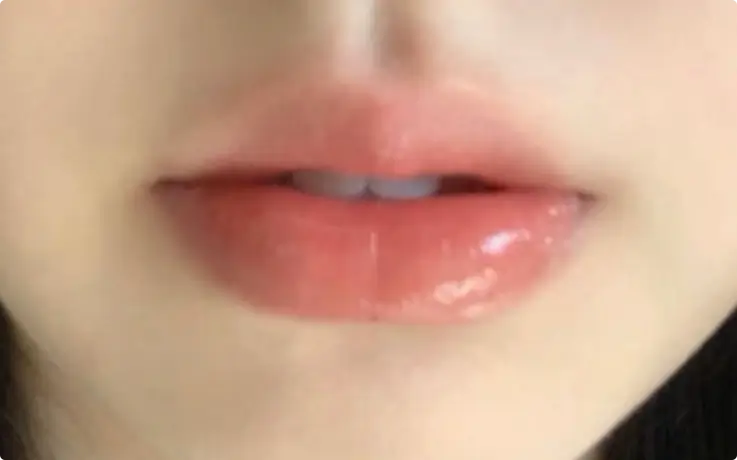 Procedure example of Lip Blush Tattoo