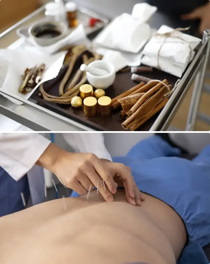 Visitor receiving acupuncture treatment at Cheongju Oriental Medicine Tourism Center.