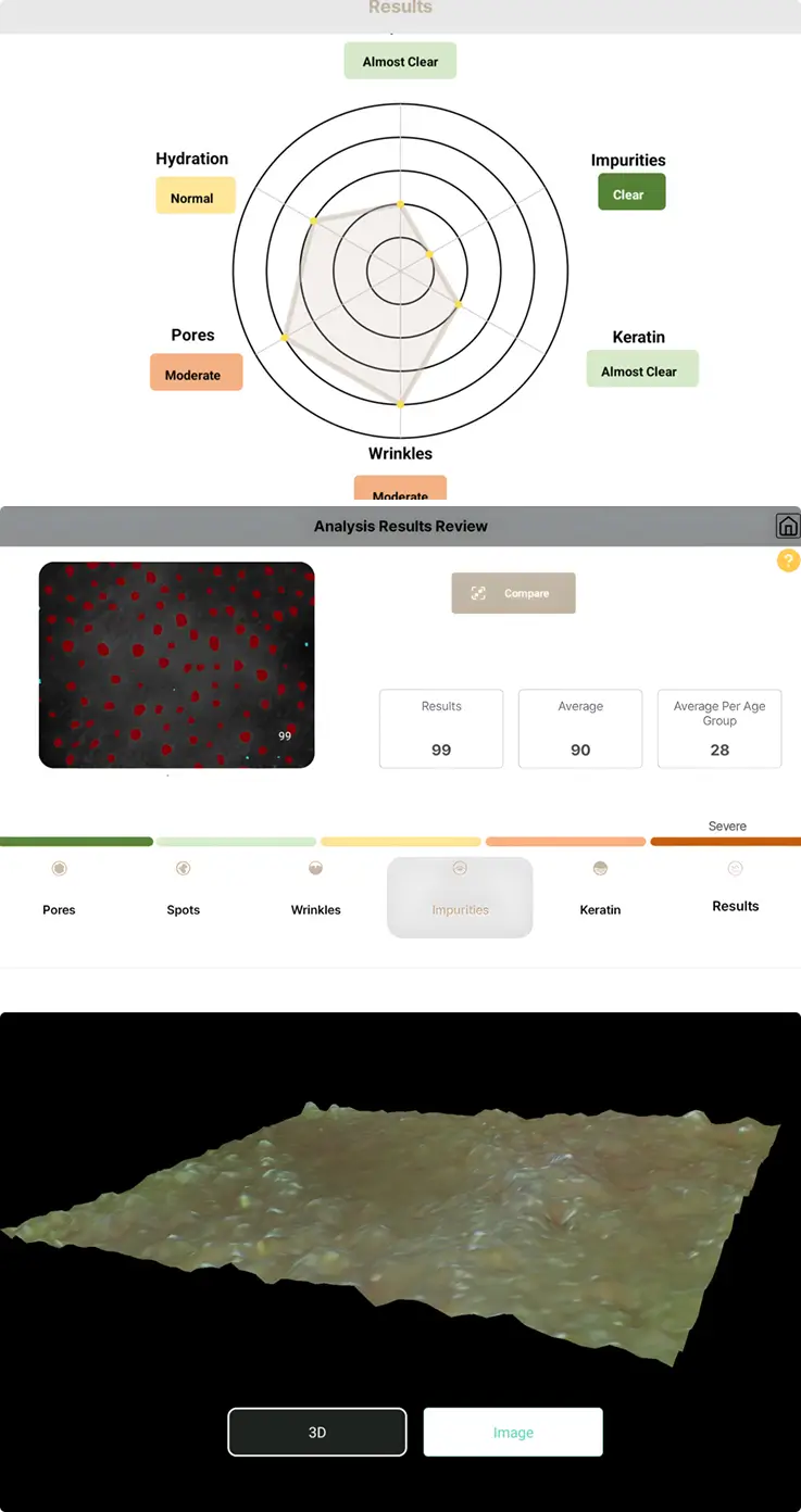 Results of the digital skin analysis performed at Individuel Geneve.