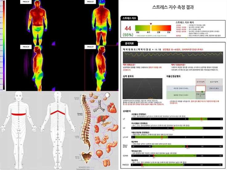 Stress level analysis chart at Bonjung Korean Medicine Clinic