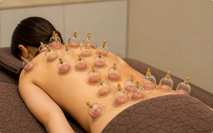 Visitor experiencing cupping therapy at Bonjung Korean Medicine Clinic