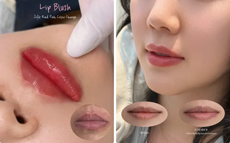 Visitors after the Lip blush procedure