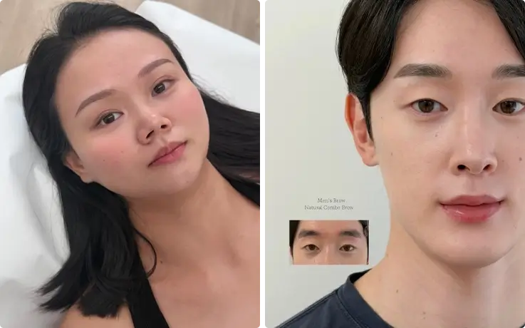 Visitors after the Combo Brows procedure
