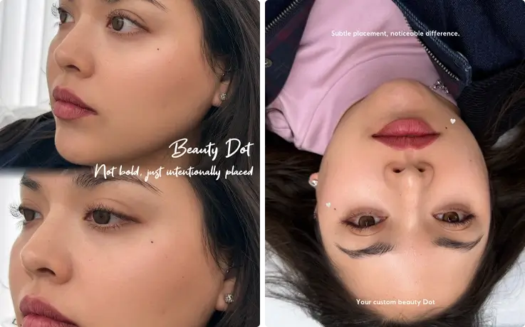 Visitors after the beauty mark procedure