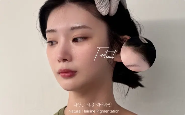 Visitors after the Hairline tattoo procedure