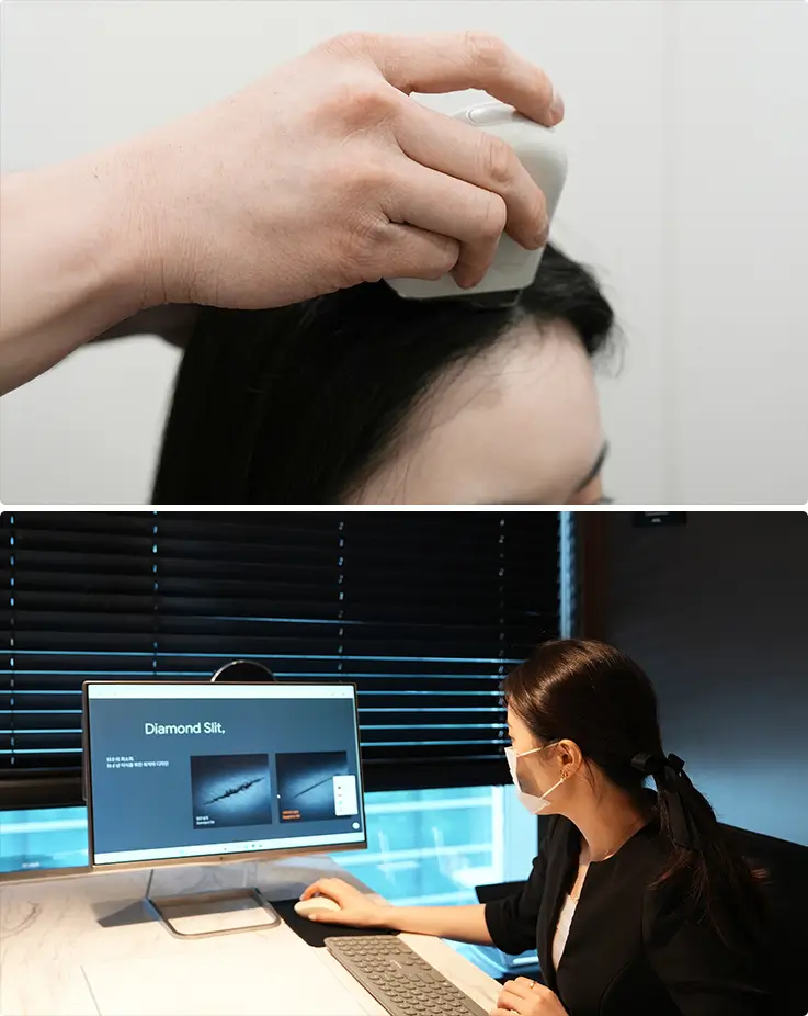 AI scalp scanner and doctor reviewing diamond slit hair transplant results together.