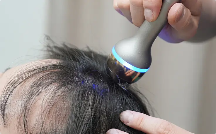 LDM Triple ultrasound device gently treating scalp with soothing blue light glow.