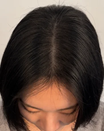 Dense, even hair part after SMP at Humanhandz in Seongsu.