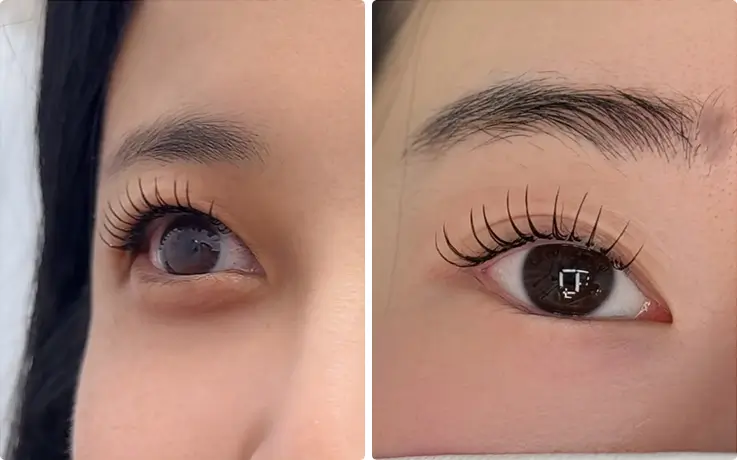 Before-and-after Korean lash lift showing dramatic curl and eye-opening effect on natural lashes.