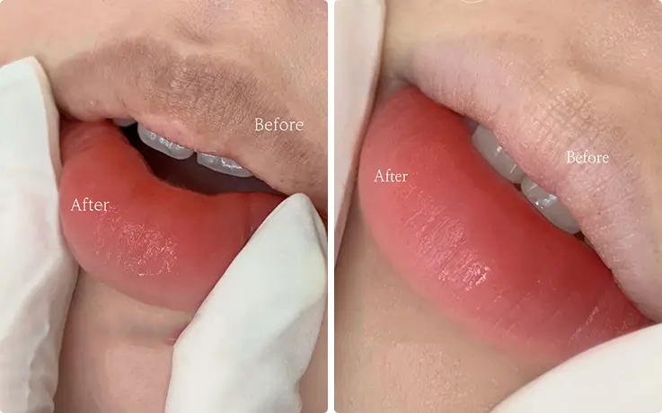 Close-up comparison of natural lip color before and after jelly lip tattoo.